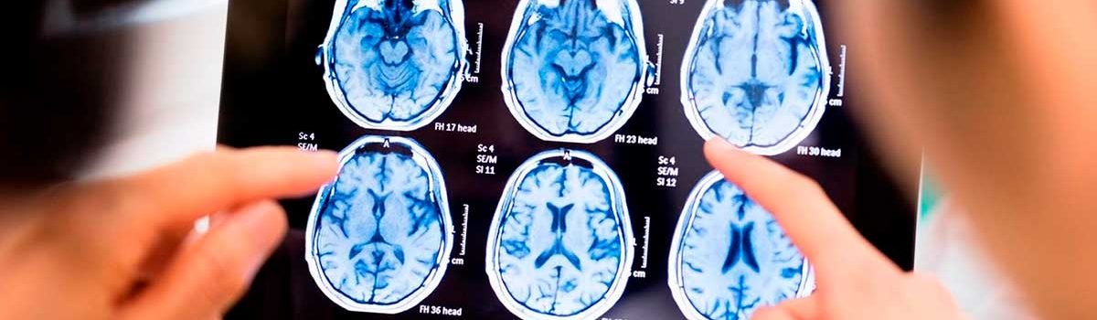 neurologia
